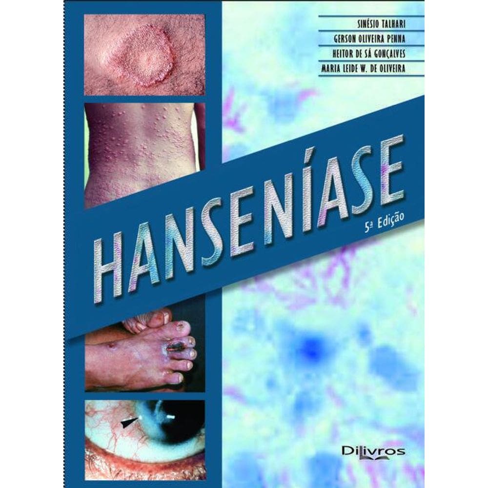 Livro Hanseníase