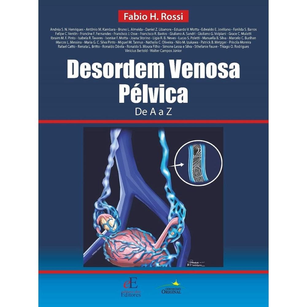 Desordem Venosa Pelvica De A A Z