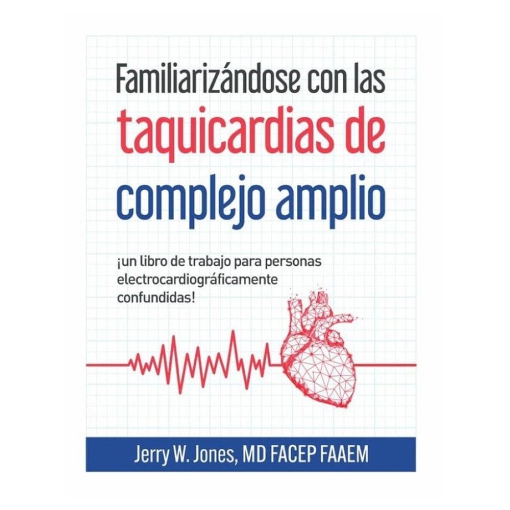 Familiarizándose con las taquicardias de complejo amplio - Espanhol