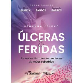 Ulceras E Feridas