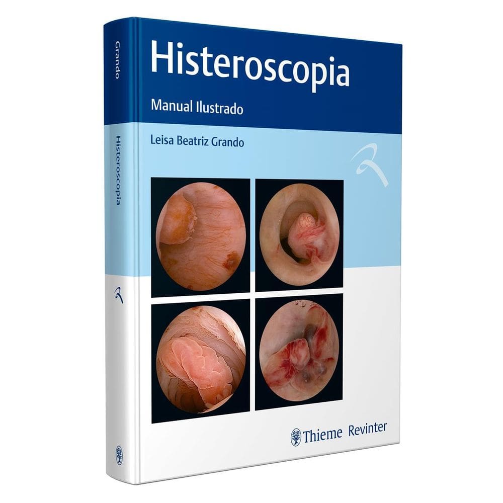 Histeroscopia: Manual Ilustrado