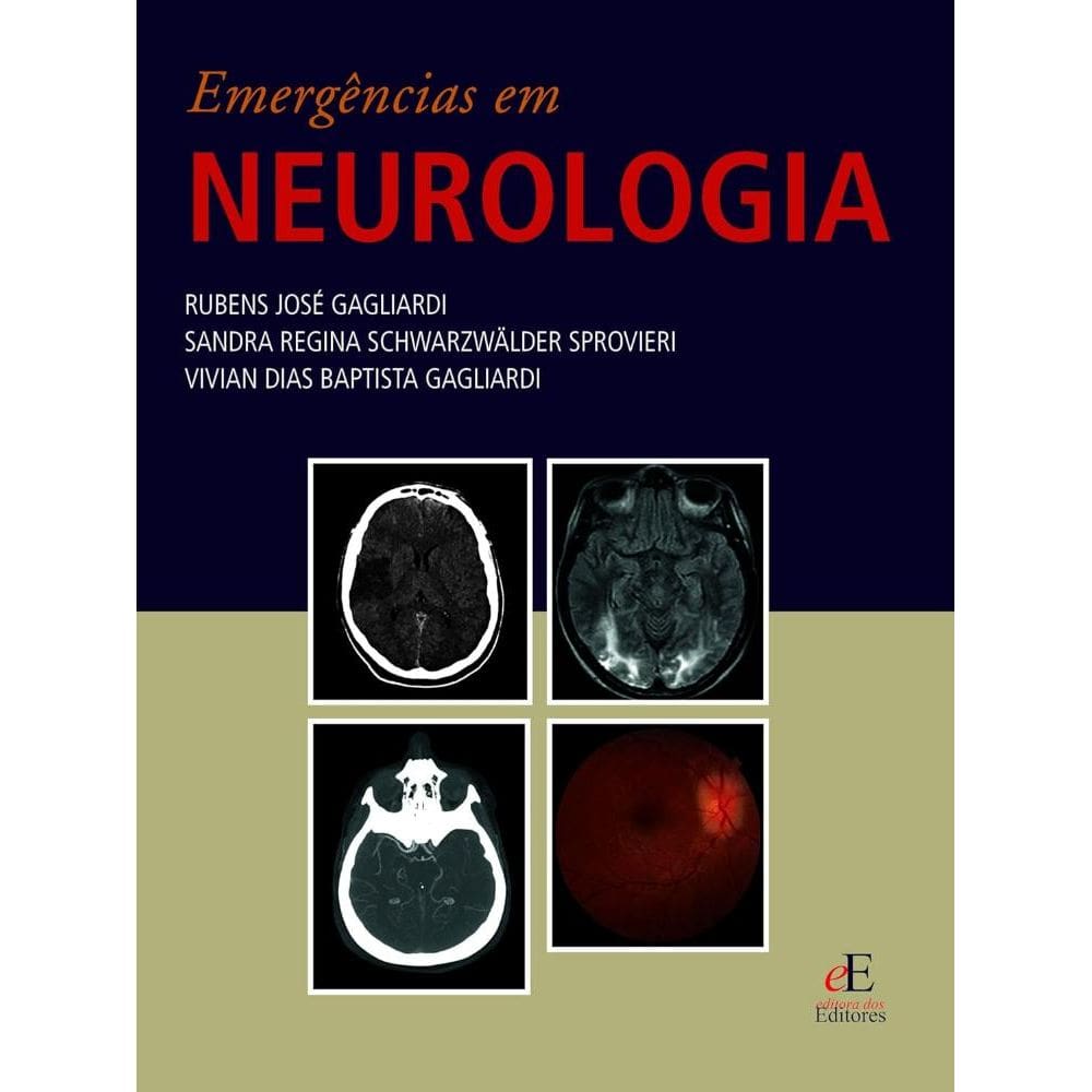Emergencias Em Neurologia (2306)