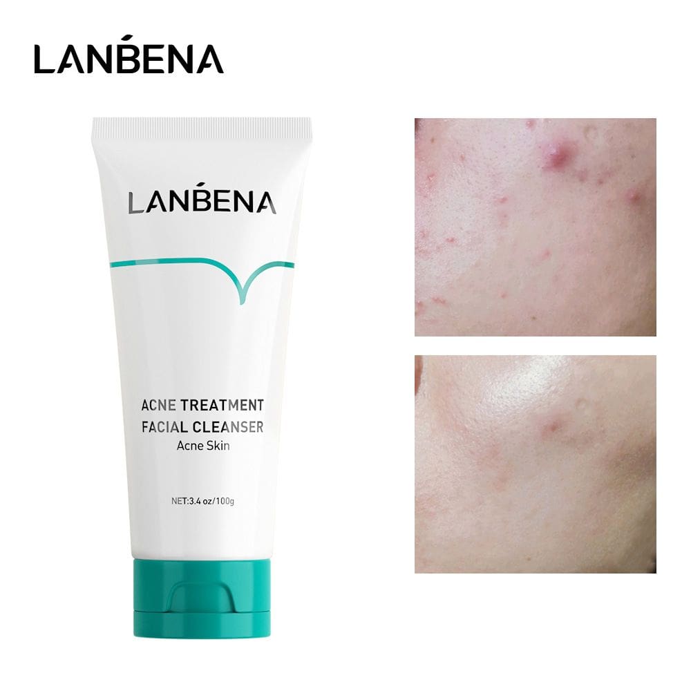Leite de limpeza de acne oligopeptídeo LANBENA