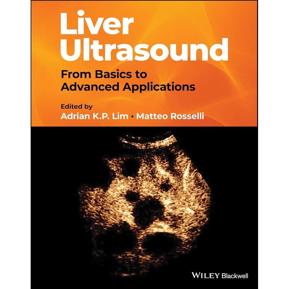 Liver Ultrasound