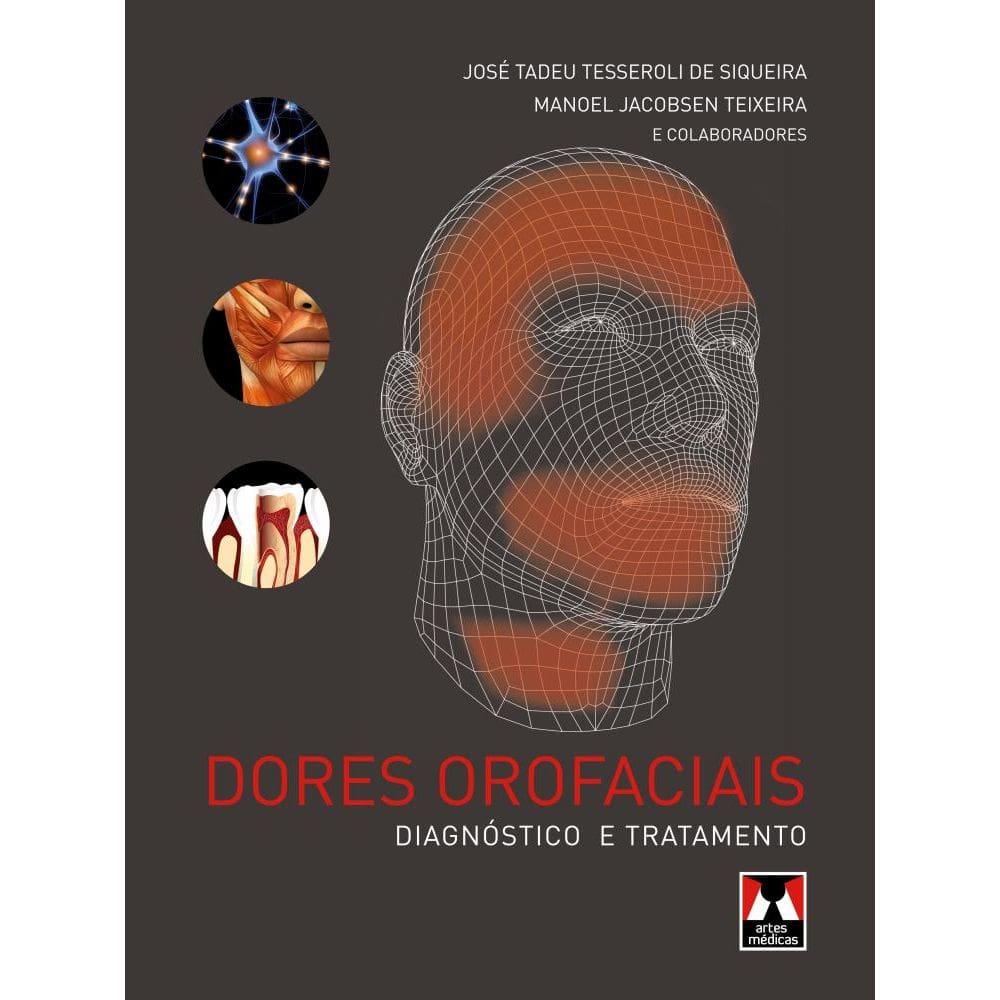 Dores Orofaciais