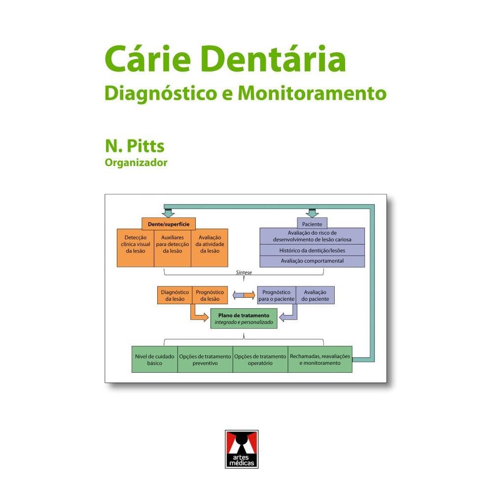 Cárie Dentária