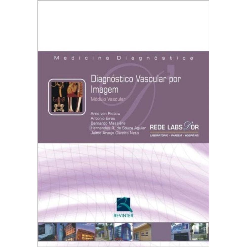 Diagnóstico Vascular Por Imagem