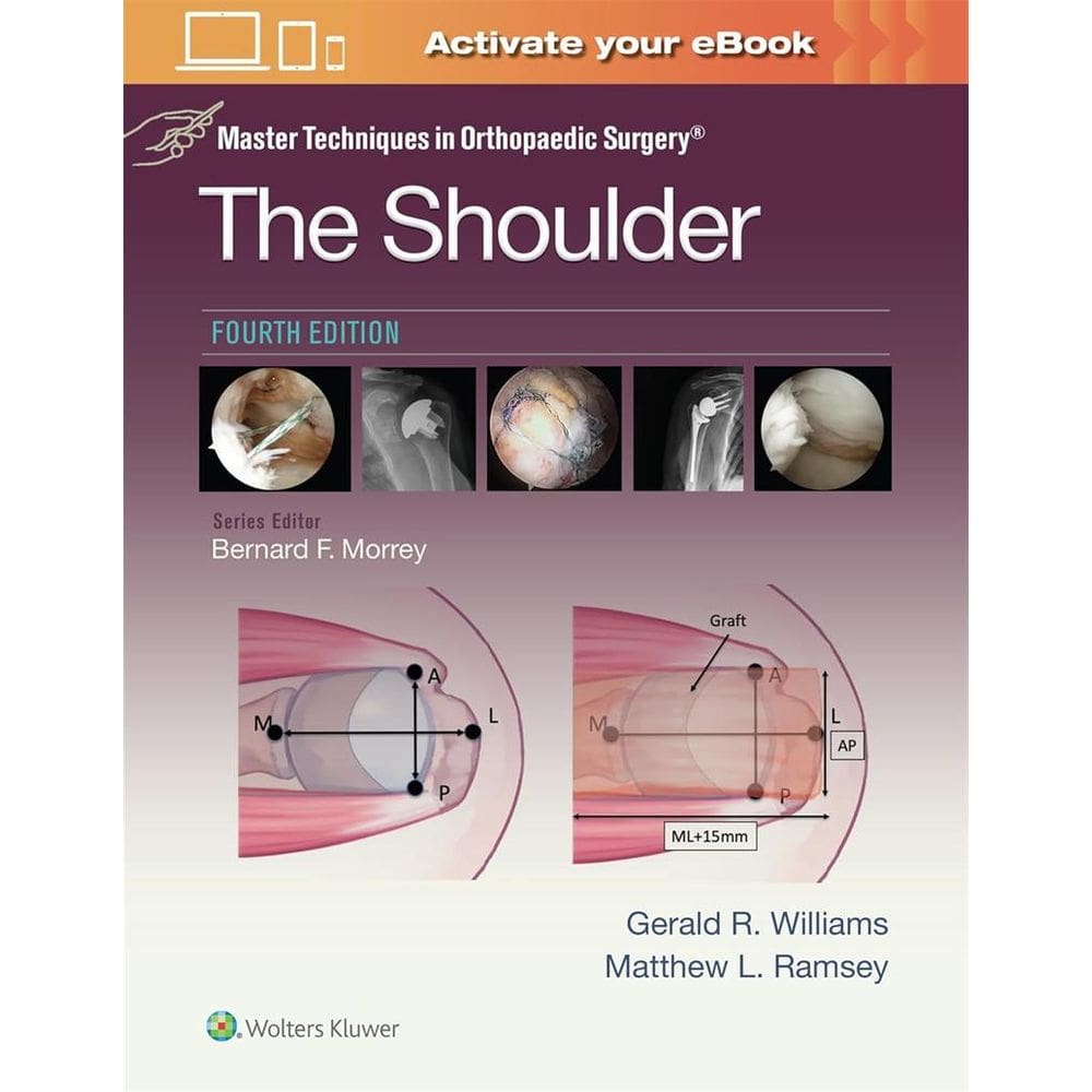 Master Techniques In Orthopaedic Surgery The Shoulder
