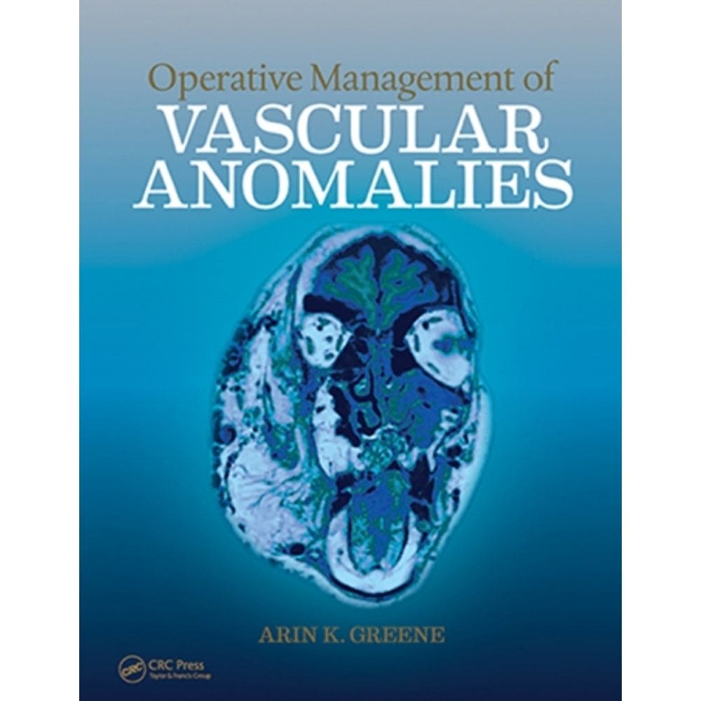 Operative Management Of Vascular Anomalies