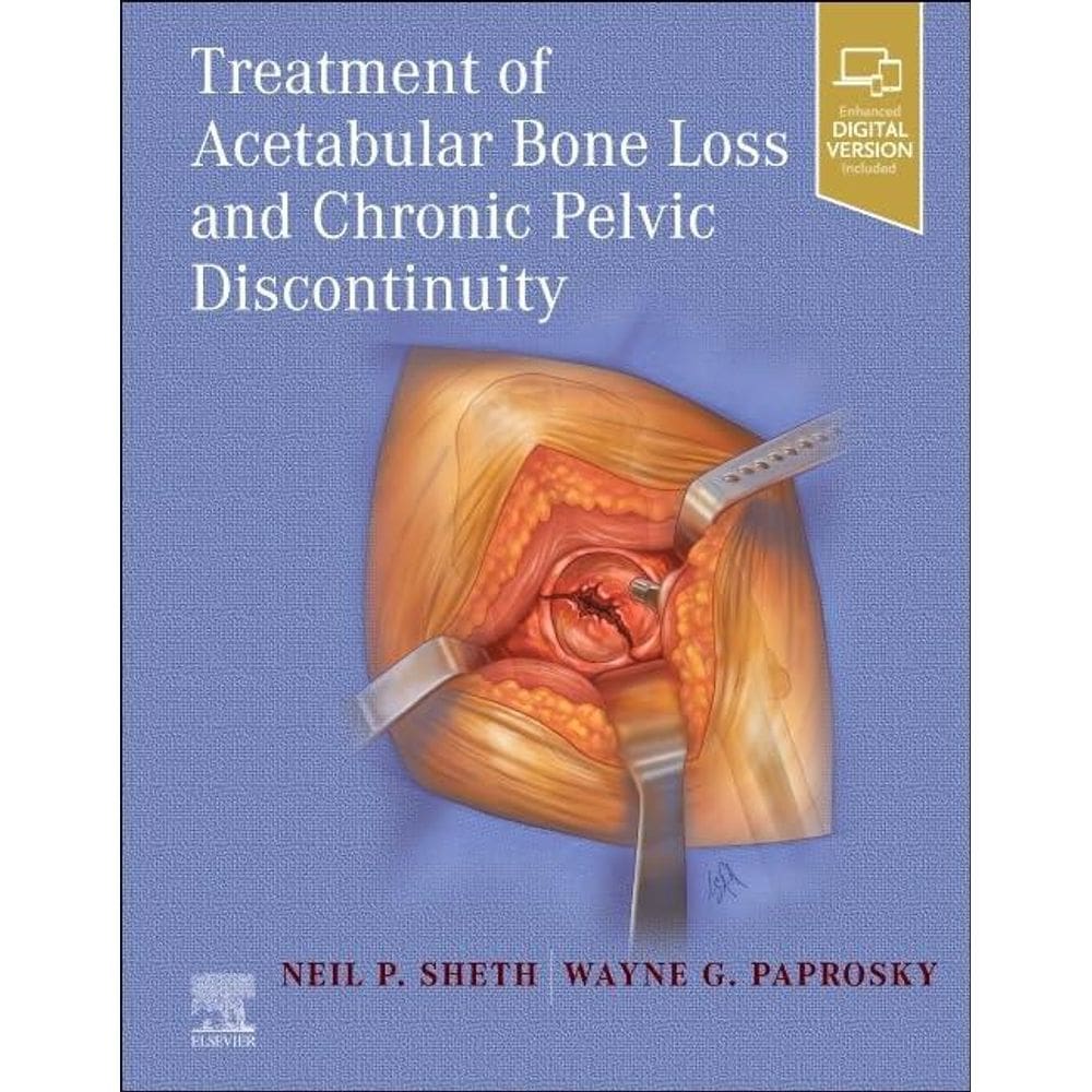Treatment Of Acetabular Bone Loss And Chronic Pelvic Discontinuity