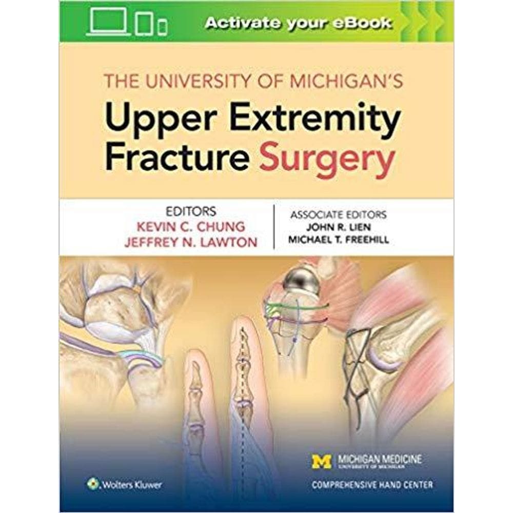The University Of Michigan`S Upper Extremity Fracture Surgery