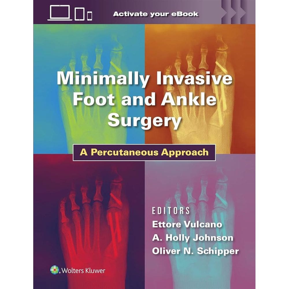 Minimally Invasive Foot and Ankle Surgery
