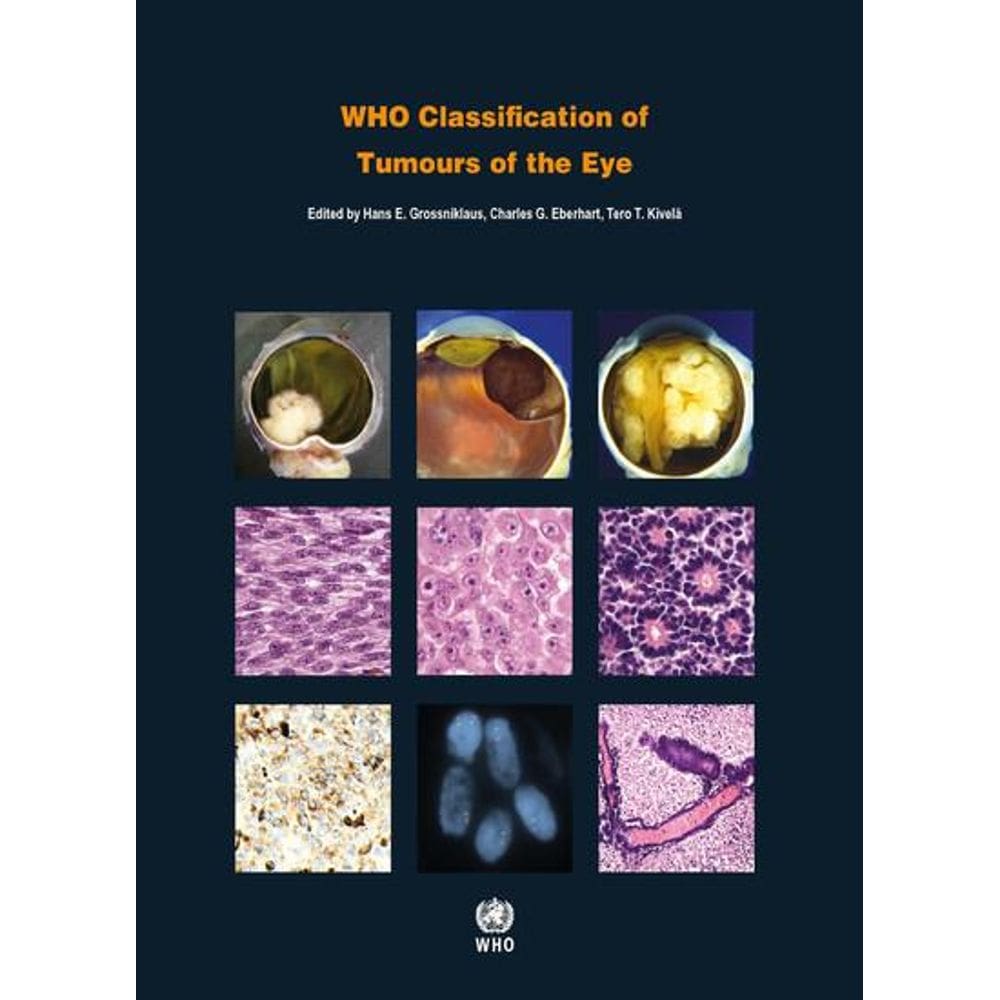 Who Classification Of Tumours Of The Eye