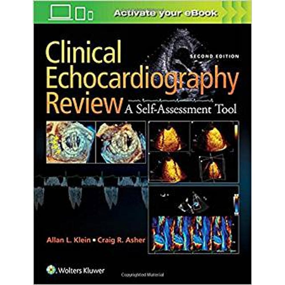 Clinical Echocardiography Review