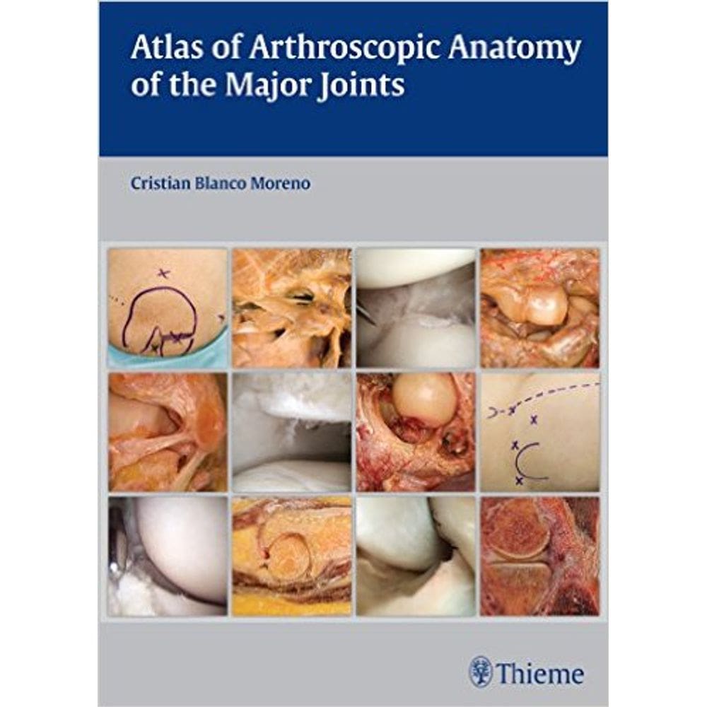 Atlas Of Arthroscopic Anatomy Of Major Joints