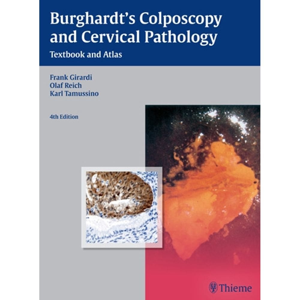 Burghardts Colposcopy And Cervical Pathology