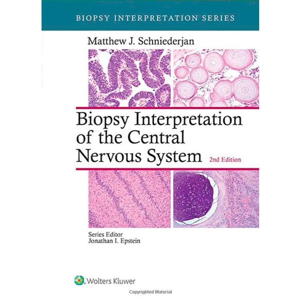 Biopsy Interpretation Of Central Nervous System