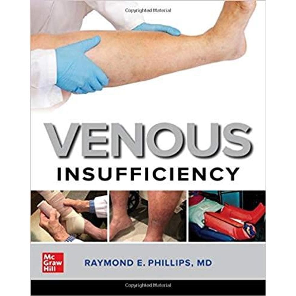 Venous Insufficiency