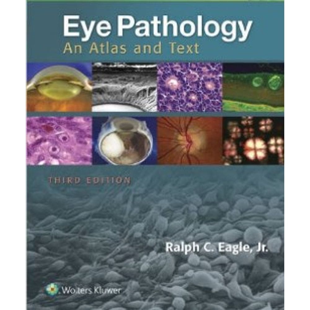 Eye Pathology