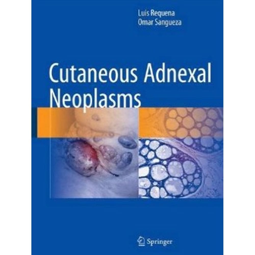 Cutaneous Adnexal Neoplasms