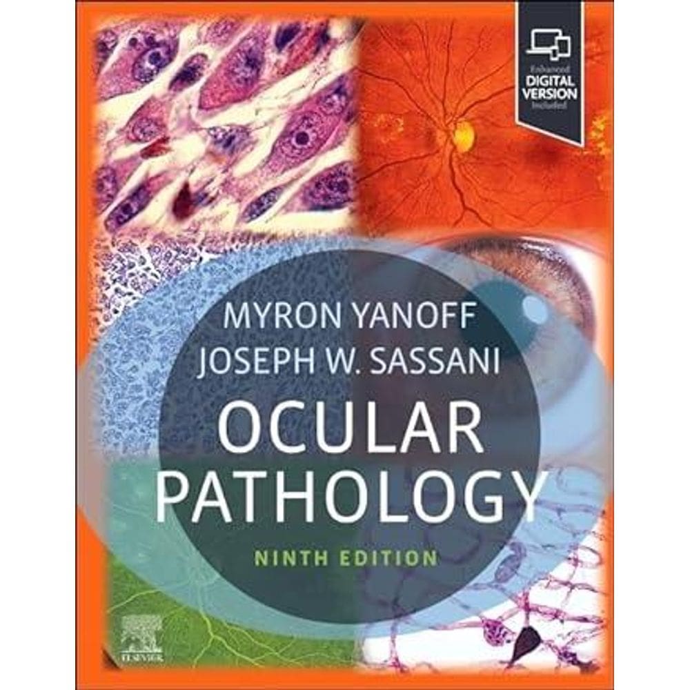 Ocular Pathology