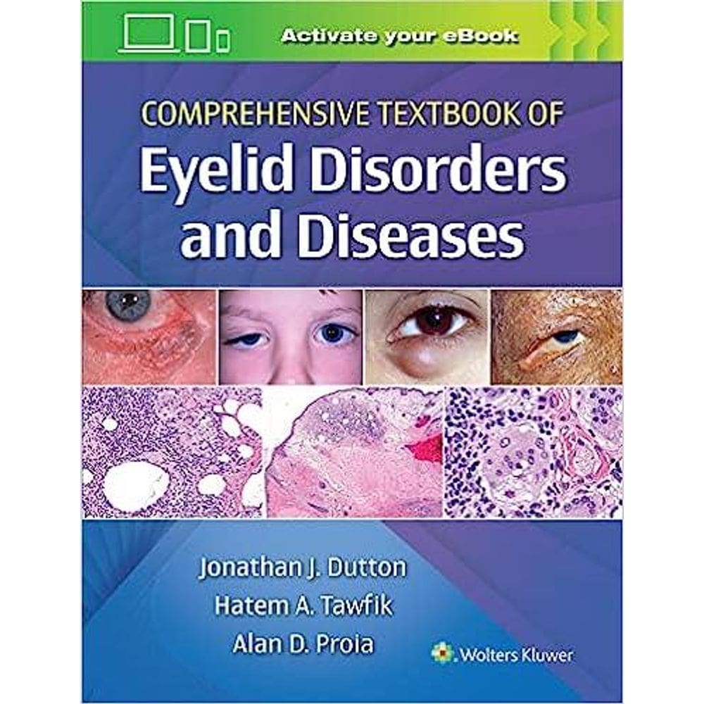 Comprehensive Textbook Of Eyelid Disorders And Diseases