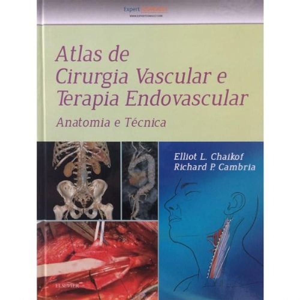 Atlas de Cirurgia Vascular e Terapia Endovascular
