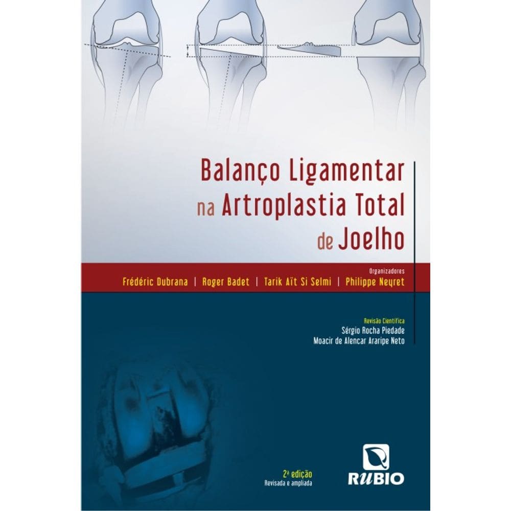 Balanco Ligamentar Na Artroplastia Total De Joelho
