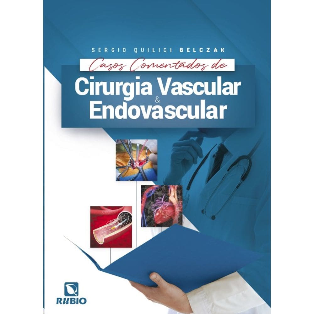 Cirurgia Vascular E Endovascular Casos Comentados De