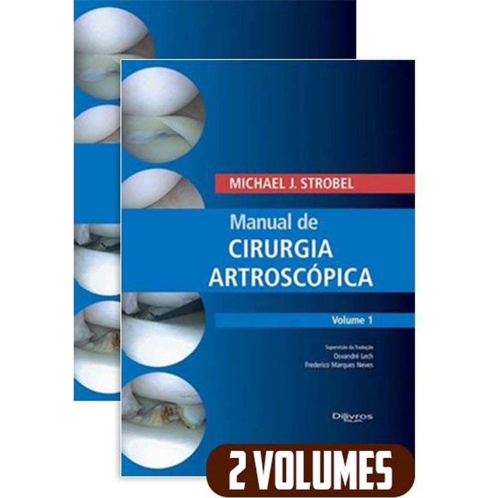 Manual de Cirurgia Artroscópica: Vol. 1