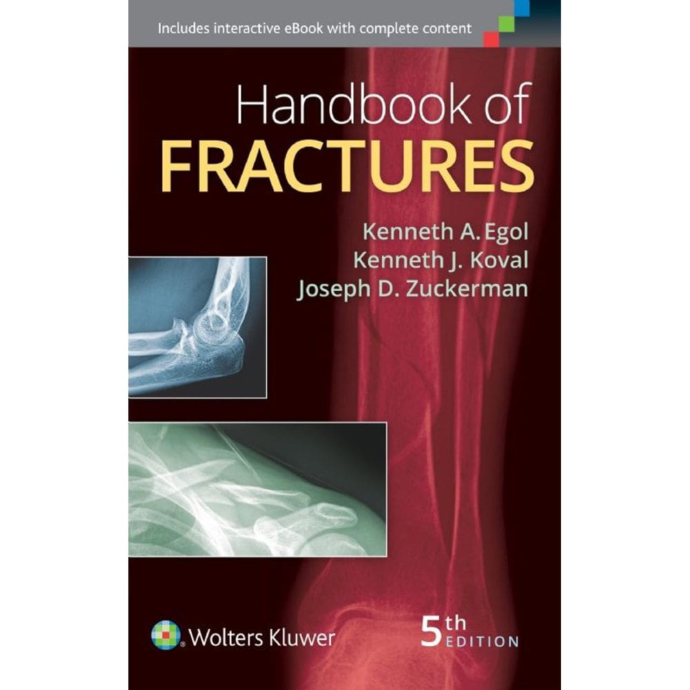 Handbook Of Fractures