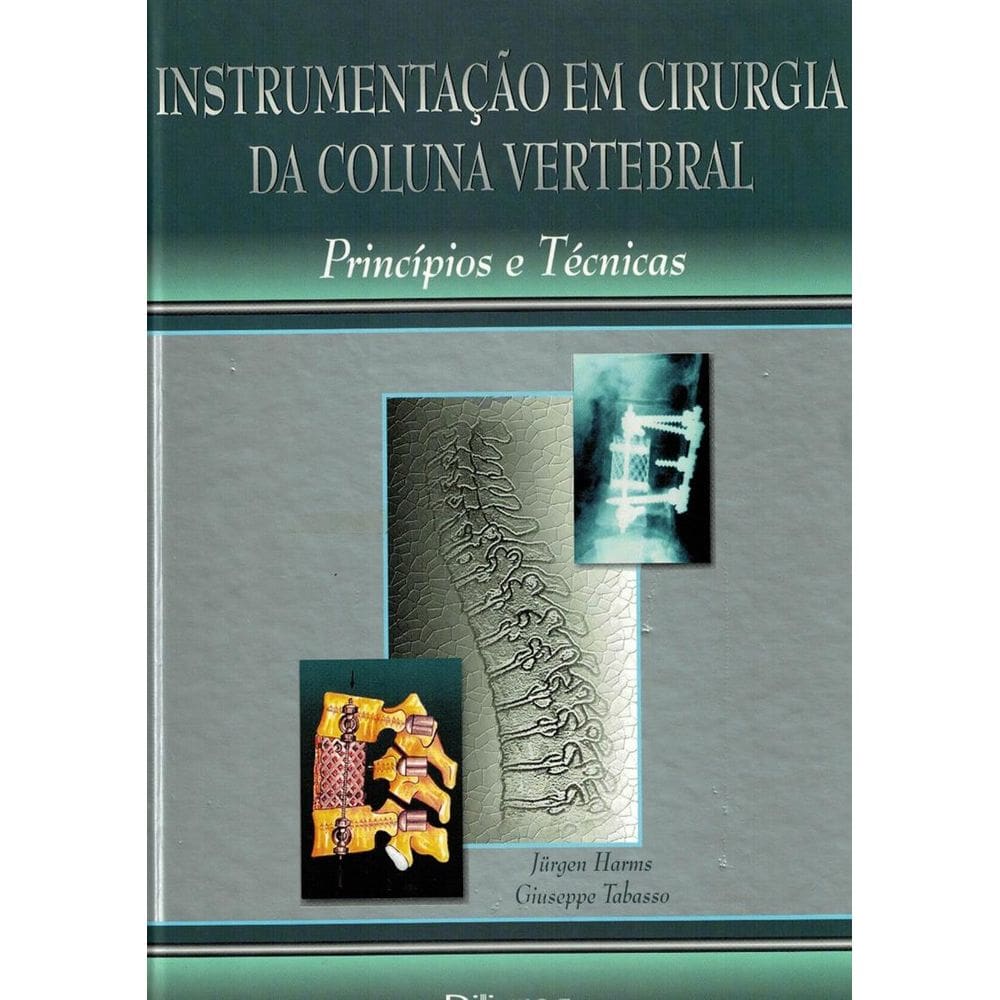 Instrumentação em Cirurgia da Coluna Vertebral