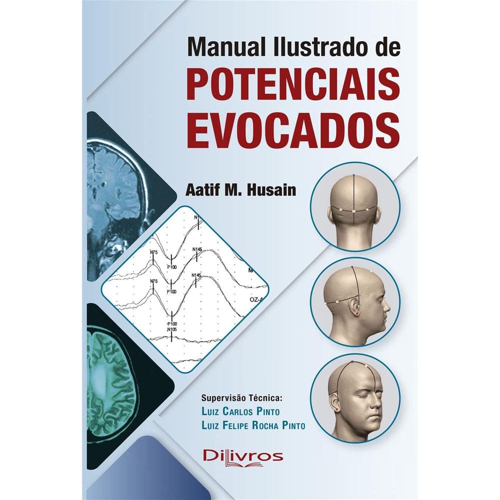 Manual Ilustrado De Potenciais Evocados