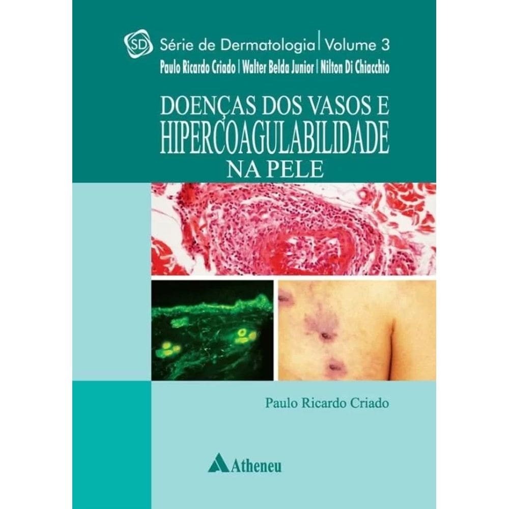 Doencas Dos Vasos E Hipercoabilidade Na Pele - Vol.3 - Serie: Dermatologica