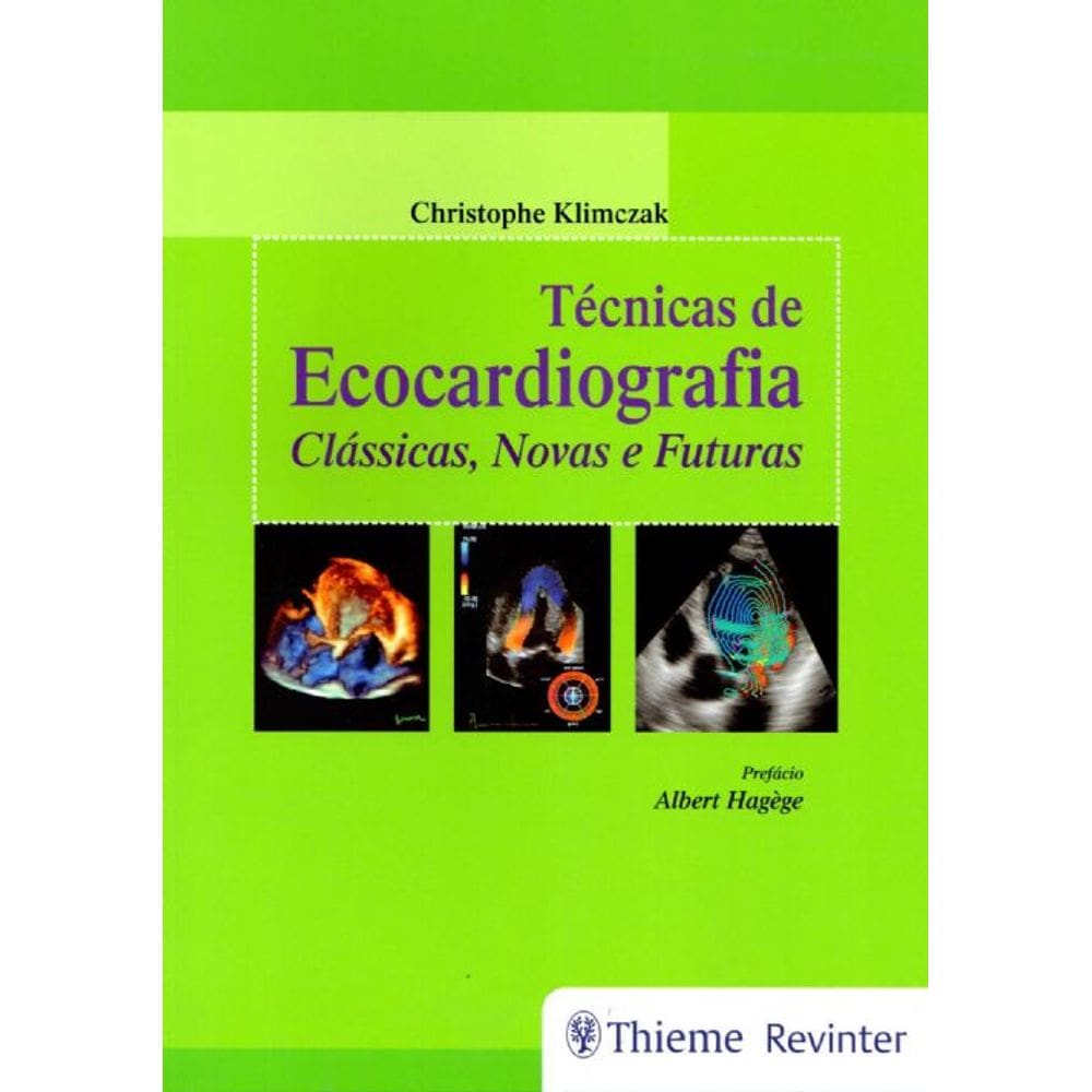 Tecnicas De Ecocardiografia - Classicas, Novas E Futuras