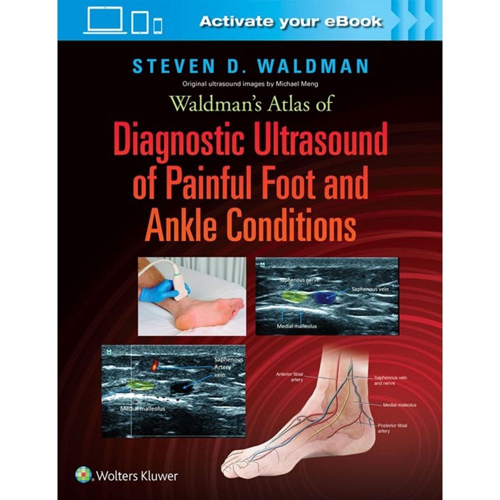 Waldmans Atlas Of Diagnostic Ultrasound Of Painful Foot And Ankle Conditio