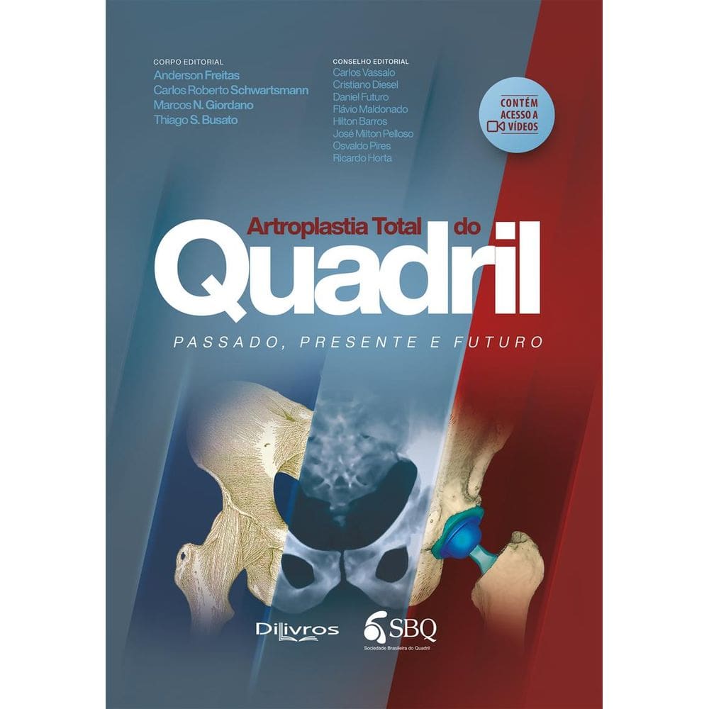 Artroplastia Total Do Quadril