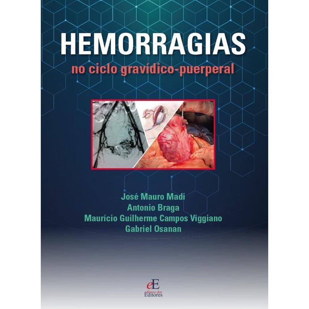 Hemorragias do Ciclo Gravídico Puerperal