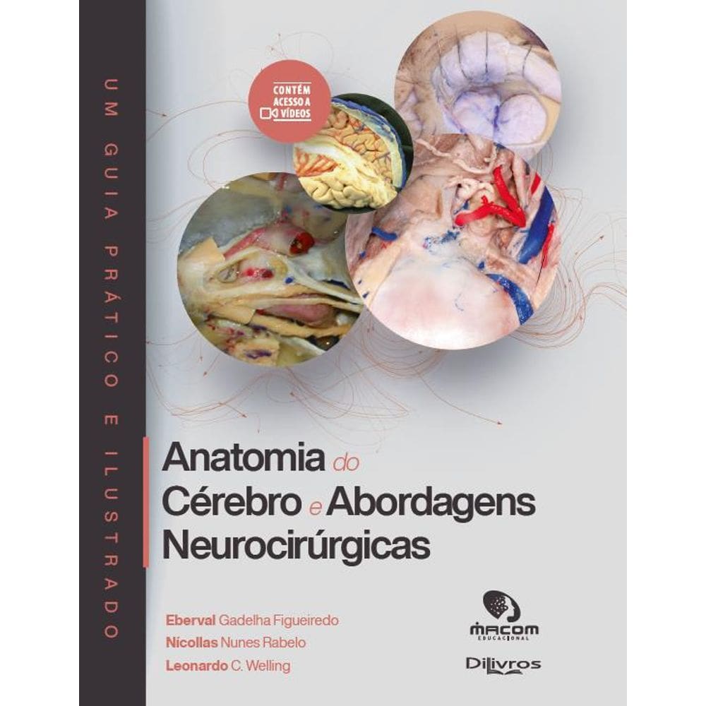 Anatomia Do Cerebro E Abordagens Neurocirurgicas