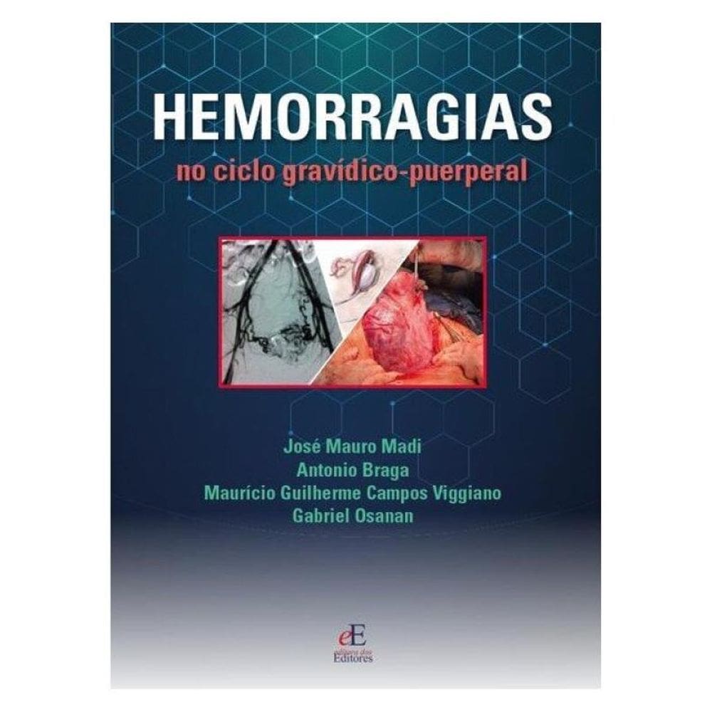 Hemorragias Do Ciclo Gravídico Puerperal
