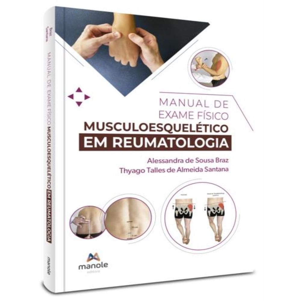 Manual De Exame Fisico Musculoesqueletico Em Reumatologia
