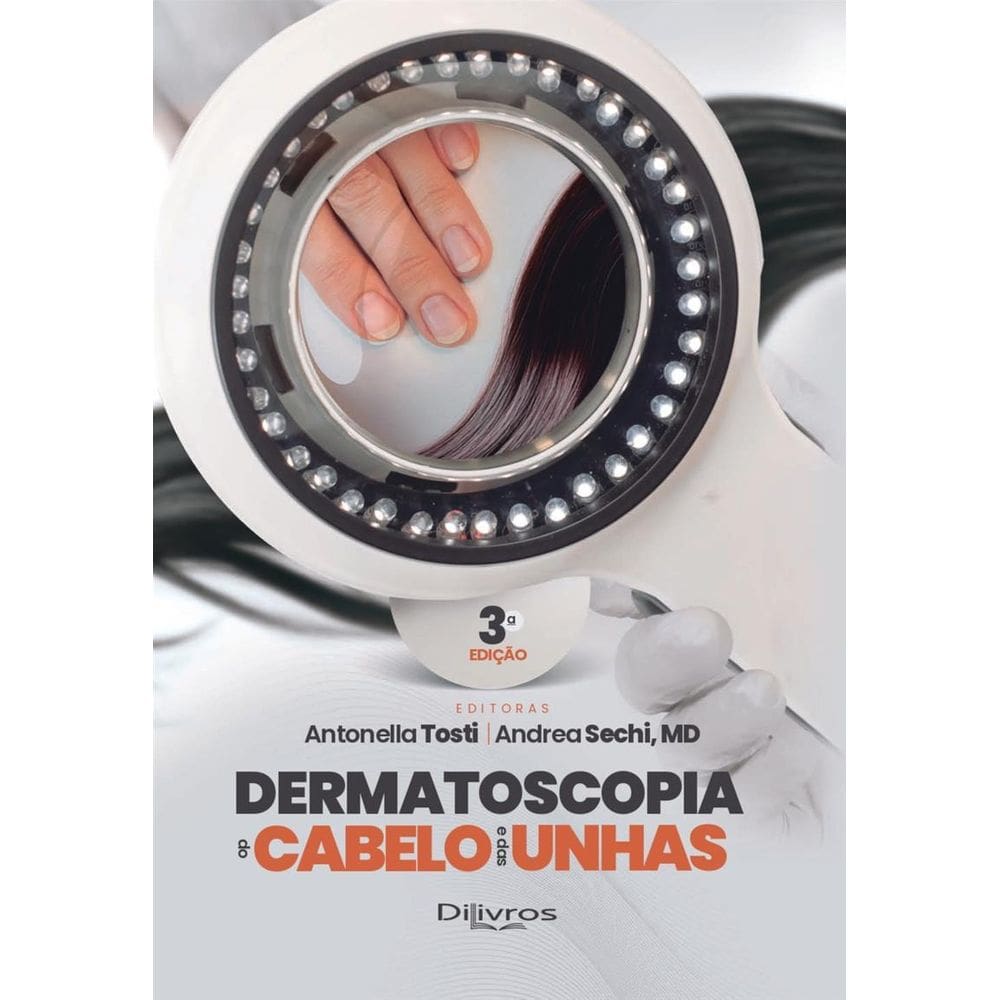 Dermatoscopia Do Cabelo E Das Unhas