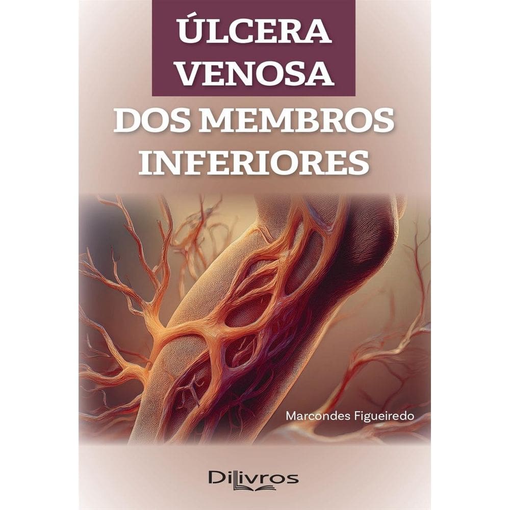 Ulcera Venosa Dos Membros Inferiores