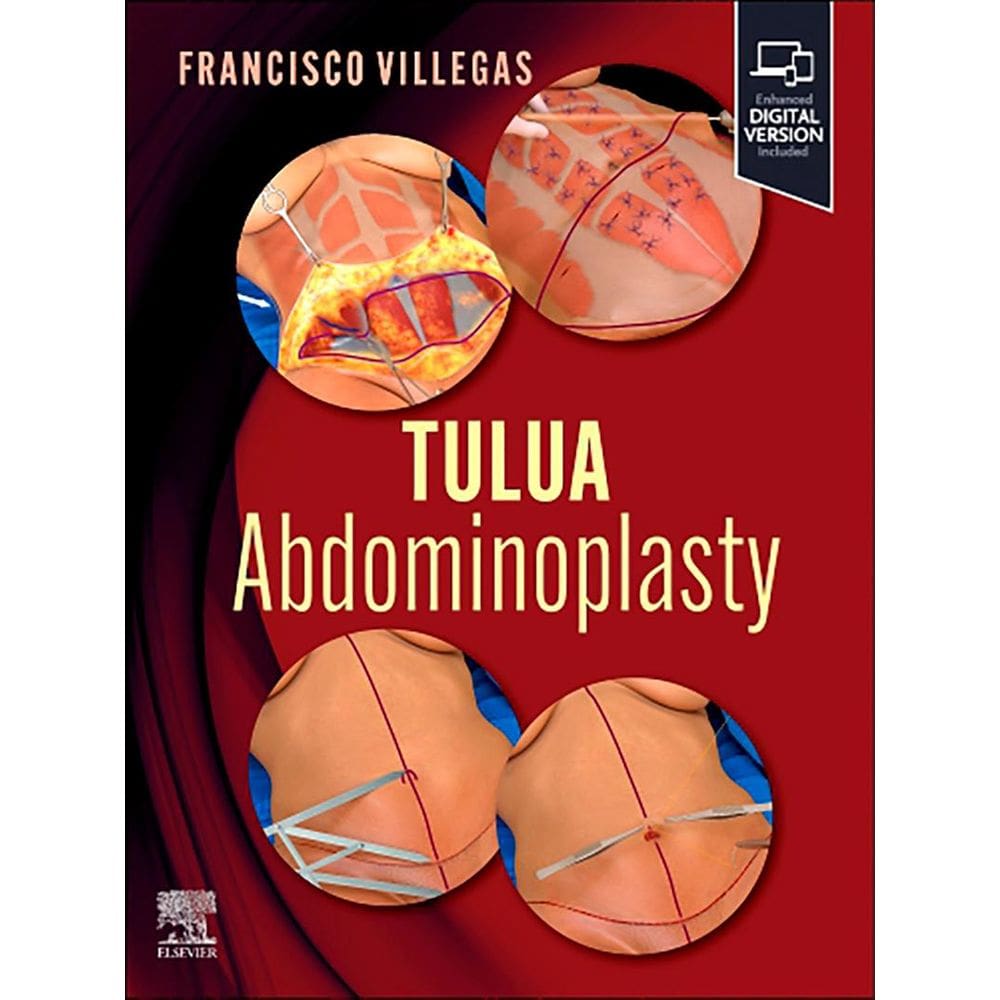 Tulua Abdominoplasty