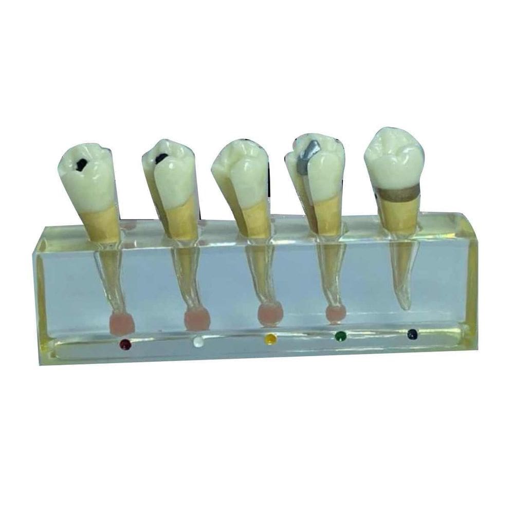 Macro Modelo Anatômico Odontológico Endodontia 4 Elementos