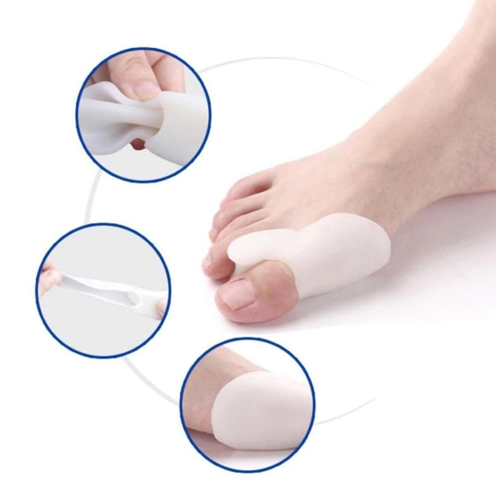Protetor de Joanete em Silicone – Corretor Postural para Pé com Alívio Imediato de Dores