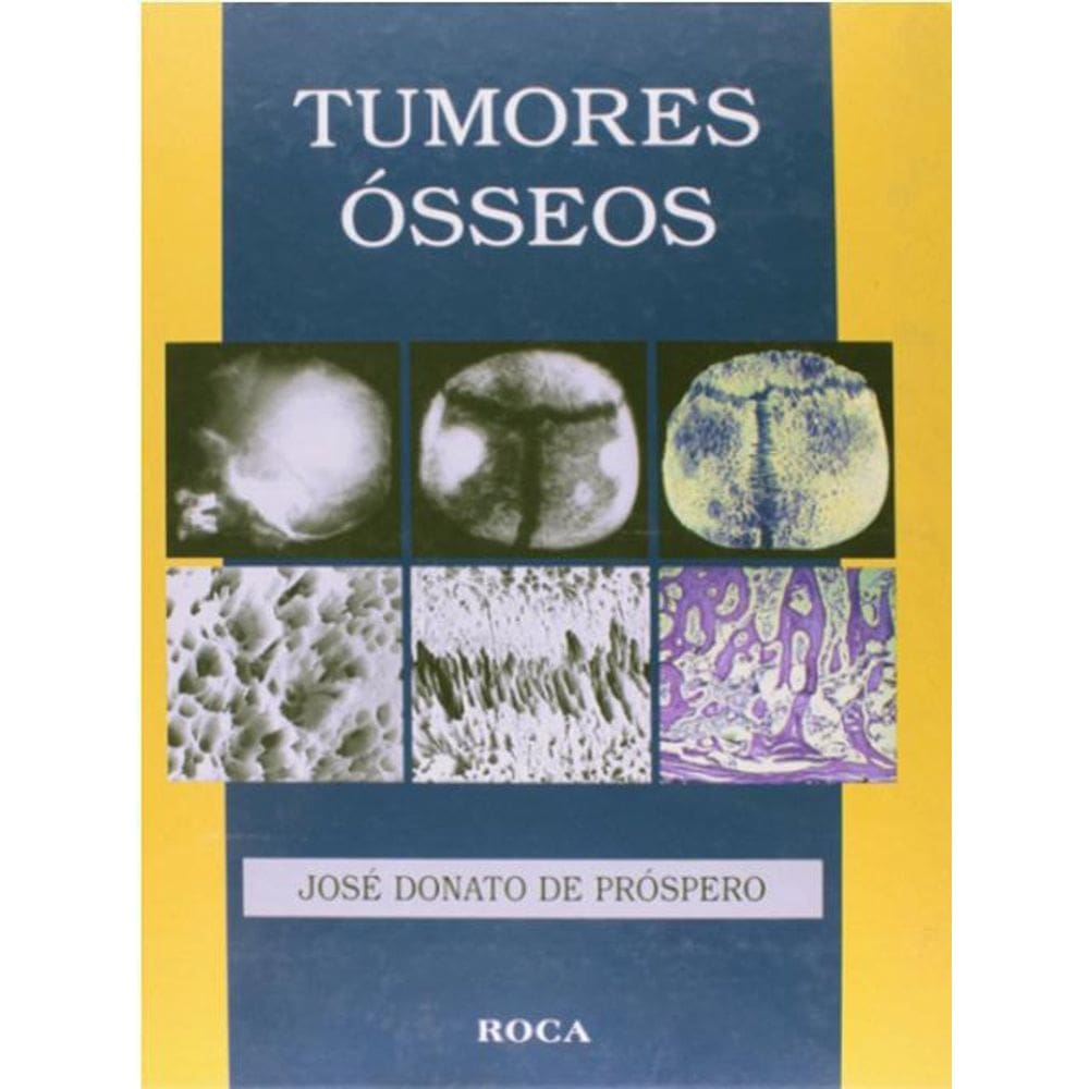 Livro Tumores Ósseos - 1ª Edição - Prospero