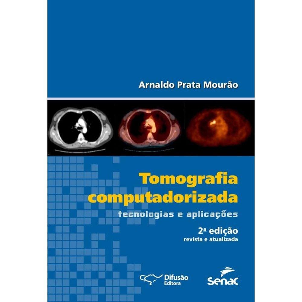 Tomografia Computadorizada Tecnologias E Aplicacoes - 2º Ed